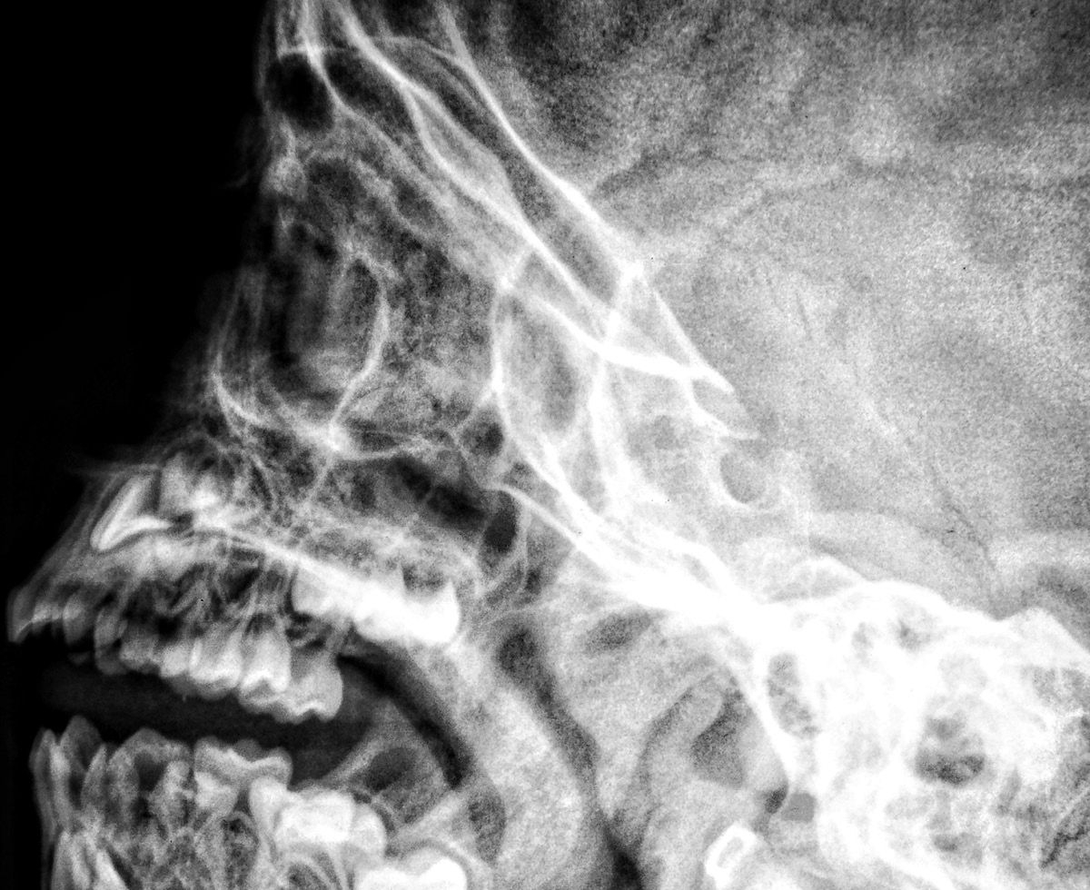 경비노동자 62시간 근무 과로사