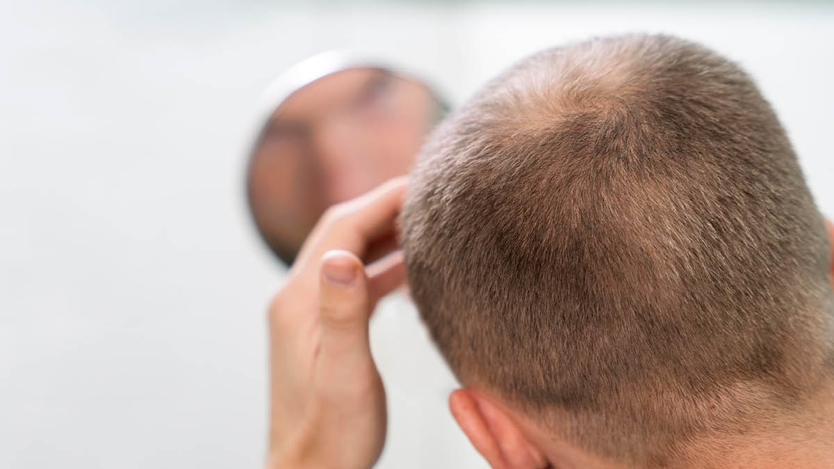 탈모 치료제? 삑- 가짜입니다 ⚠️