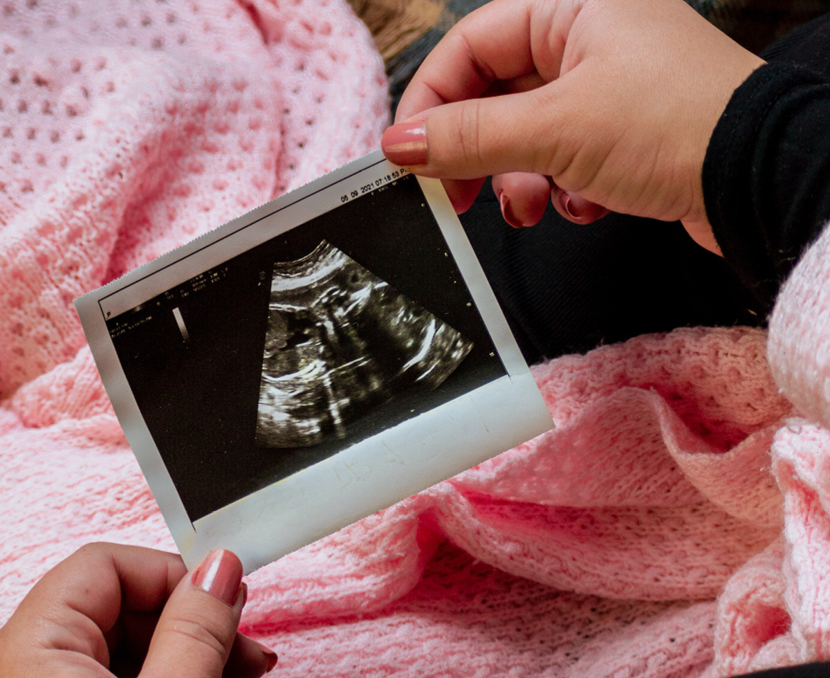 서울시: “난임 부부 지원합니다” 👶